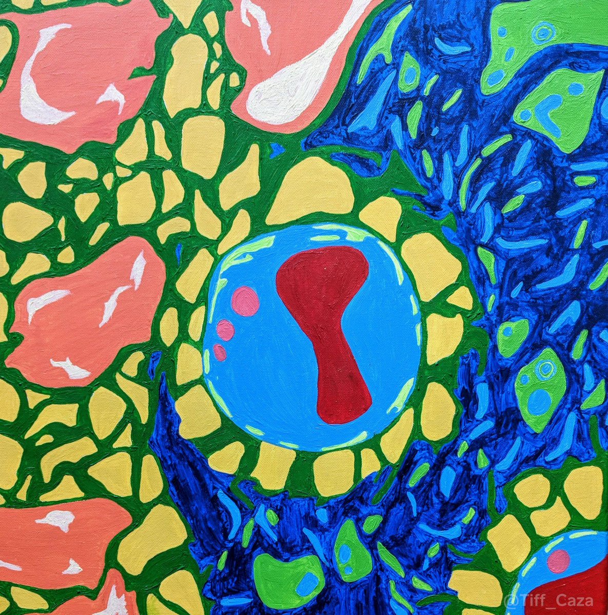arkanalabs's tweet photo. #LupusLesson The painting below, by @Tiff_Caza, shows electron microscopy of two glomerular capillary loops and a mesangial region from a case of membranous lupus nephritis, showing intramembranous and mesangial electron-dense deposits.
Learn more about Membranous Lupus Nephritis here: https://t.co/4Gh6L9AzIQ
#ArtOfMedicine #LupusAwarenessMonth #PathArt