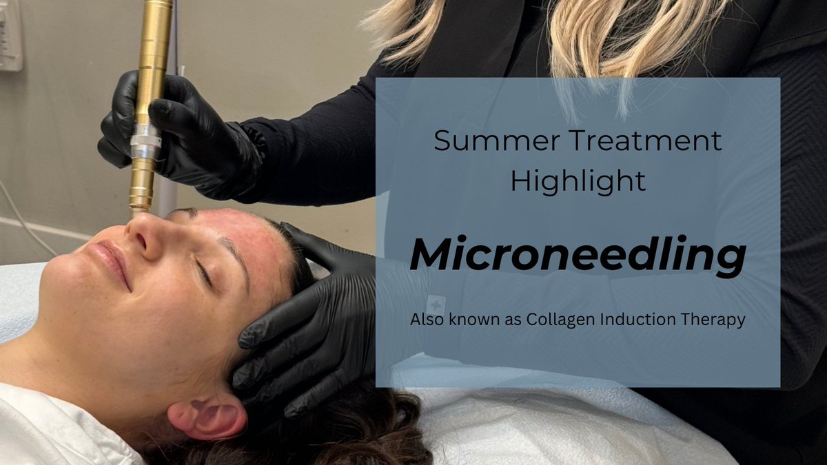 Summer's heat calls for caution! While we have to stay away from some aggressive treatments, microneedling is always a good idea ☀️

📞 Call 404-348-4456 to book your appointment

#Skincare #Summer 

plasticsurgerygroupatl.com/procedures/non…