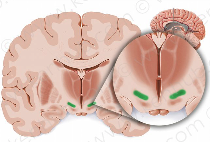 STN serves as the brain's primary pincushion for DBS.

But it has important and fascinating functions beyond that. 

Subthalamic nucleus anatomy and function thread…