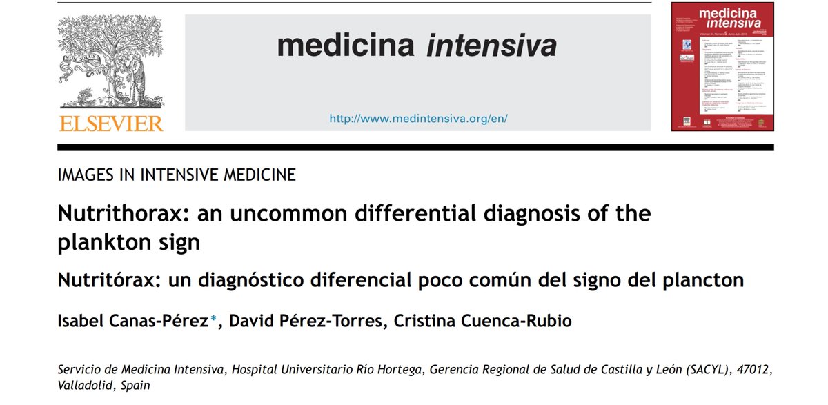 🤔Have you ever seen a pleural effusion with swirling, punctiform internal echoes? 🌀

➡️This is named the plankton sign &amp; it is common in exudative or hemorrhagic effusions.

We report another uncommon differential diagnosis 👇🏻
🆓authors.elsevier.com/a/1j7%7E37kDfM…

#FOAMcc #POCUS #echo