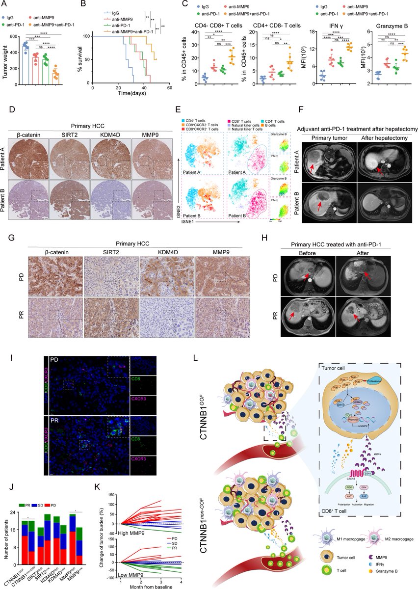 #GUTImage from the paper by Cai et al on

'Targeting MMP9 in CTNNB1 mutant hepatocellular carcinoma restores CD8+ T cell-mediated antitumour immunity and improves anti-PD-1 efficacy' via bit.ly/4atUahz

#HCC #LiverTwitter