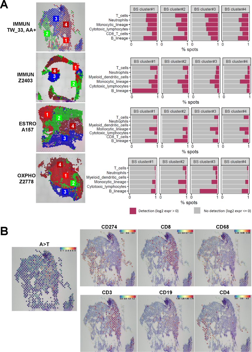 #GUTImage from the paper by Hong et al on 

'Integrative multiomics enhancer activity profiling identifies therapeutic vulnerabilities in cholangiocarcinoma of different etiologies' via

bit.ly/4btuaUW

#Cholangiocarcinoma