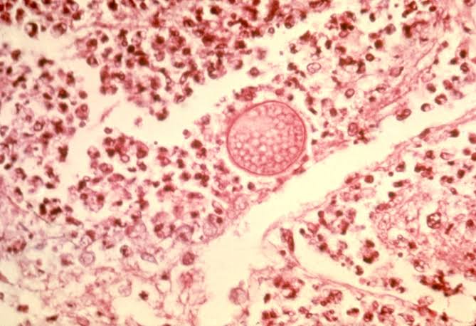Coccidioides immitis es un hongo patógeno dimórfico común en zonas semideserticas con suelo alcalino, su forma micelial son artroconidios con células disyuntoras y su forma de levadura es como esferulas con endoesporas.