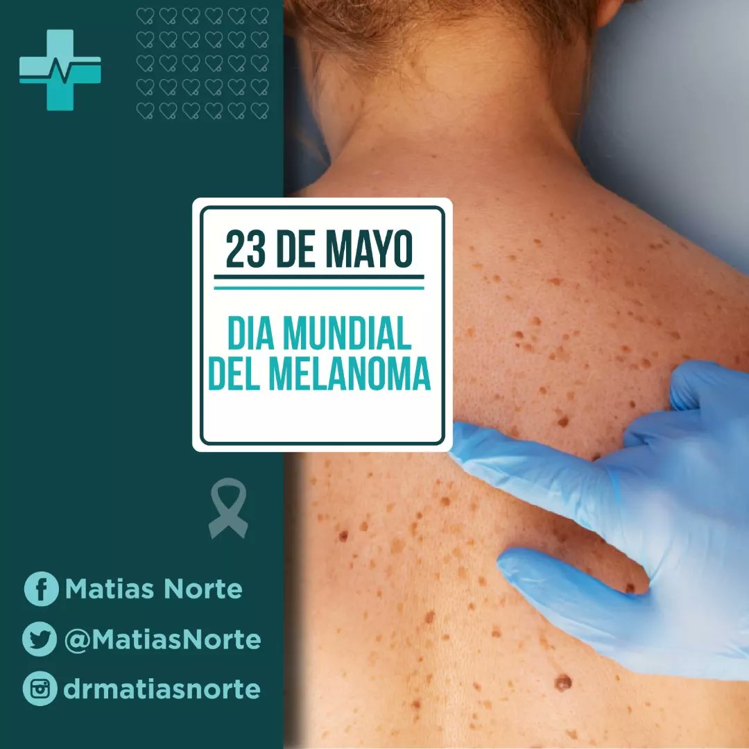 MatiasNorte's tweet photo. 23 de Mayo día  mundial de la lucha contra el melanoma.

En #argentina se diagnostican 1700 casos por año 
600 pacientes fallecen en el mismo periodo de tiempo

#prevencion #sol #melanoma #oncologia #salud https://t.co/GicvpZmkJH