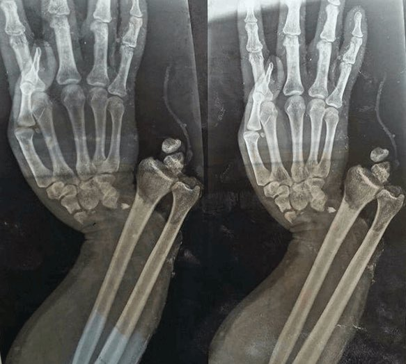 me estaba haciendo una paja y me ha pasado esto que deberia hacer