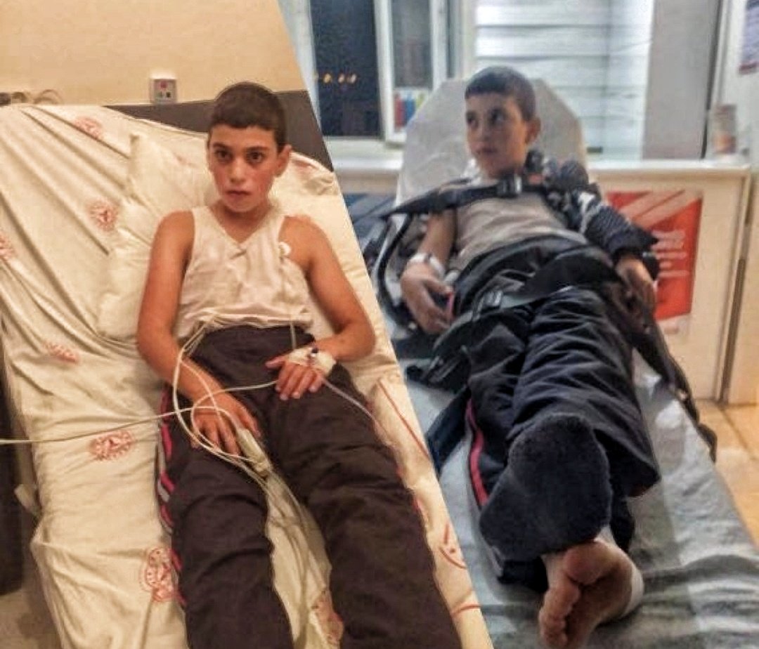 merhum_cuykov's tweet photo. Mesela bu çocuğun 21. yüzyılda kuduz nedeniyle ölmesine sebep oldunuz. Bu örneklerden sadece biri.

İki tane tatlış köpek fotoğrafıyla anca IQ'su ayakkabı numarasından küçük sığırları güdersiniz. Biz bunlara götümüzle gülüyoruz. https://t.co/WpmsTXrKh2
