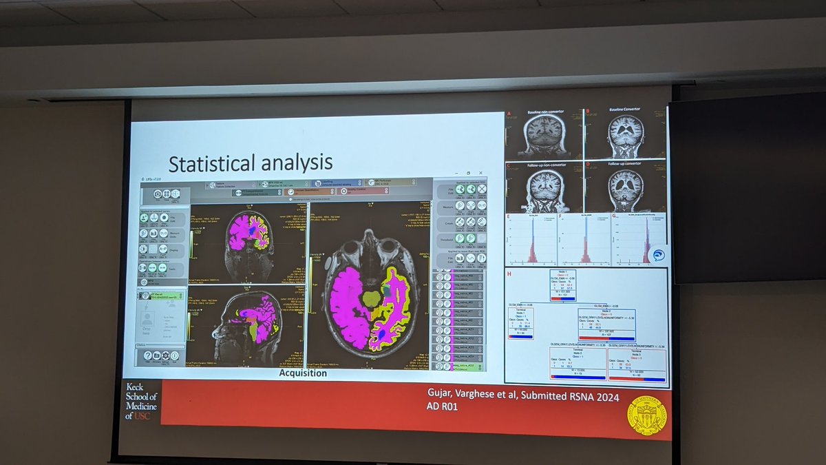 RadiologyUSC's tweet photo. Collaboration and Innovation in Radiology Research, pt II. When the topic so nice, you've offer it twice ✌️. 

Thanks to our rockstars, Kai Chen and Bino Varghese.  Together, along with  partners,  you're lining up a collaborative renaissance, #Radiochemistry to #Radiomics! https://t.co/jgwwx11eQF