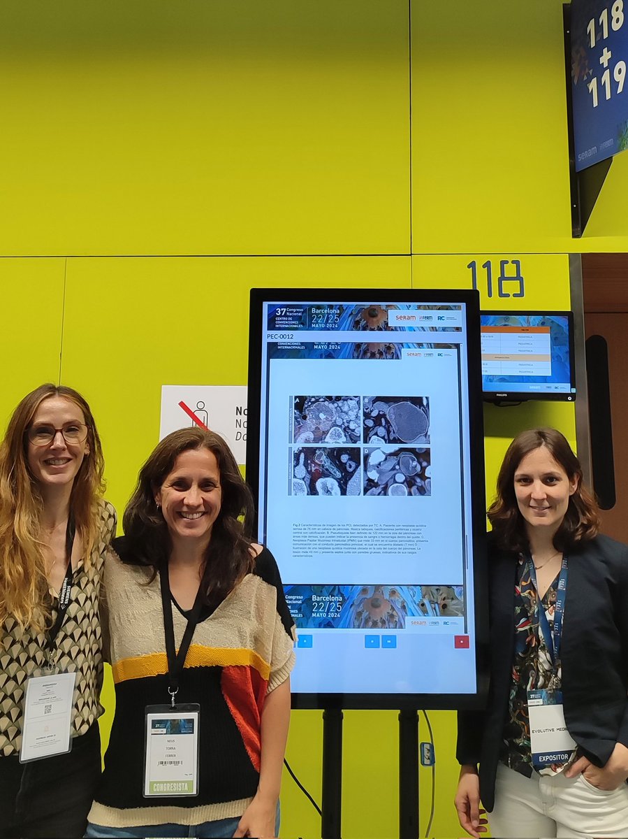Julia_RoComas's tweet photo. Had a great time at the @SERAM_RX event in #Bcn, discussing the role of #AI in #radiology.

Thrilled to present our study conducted at @CSdMaresme and @htrueta.

Visit us at #EvolutiveMedica booth for a @SycaiT demo! Excited to connect with everyone.

#SERAM2024 #Radiology #Sycai https://t.co/HhhTh8UWIm