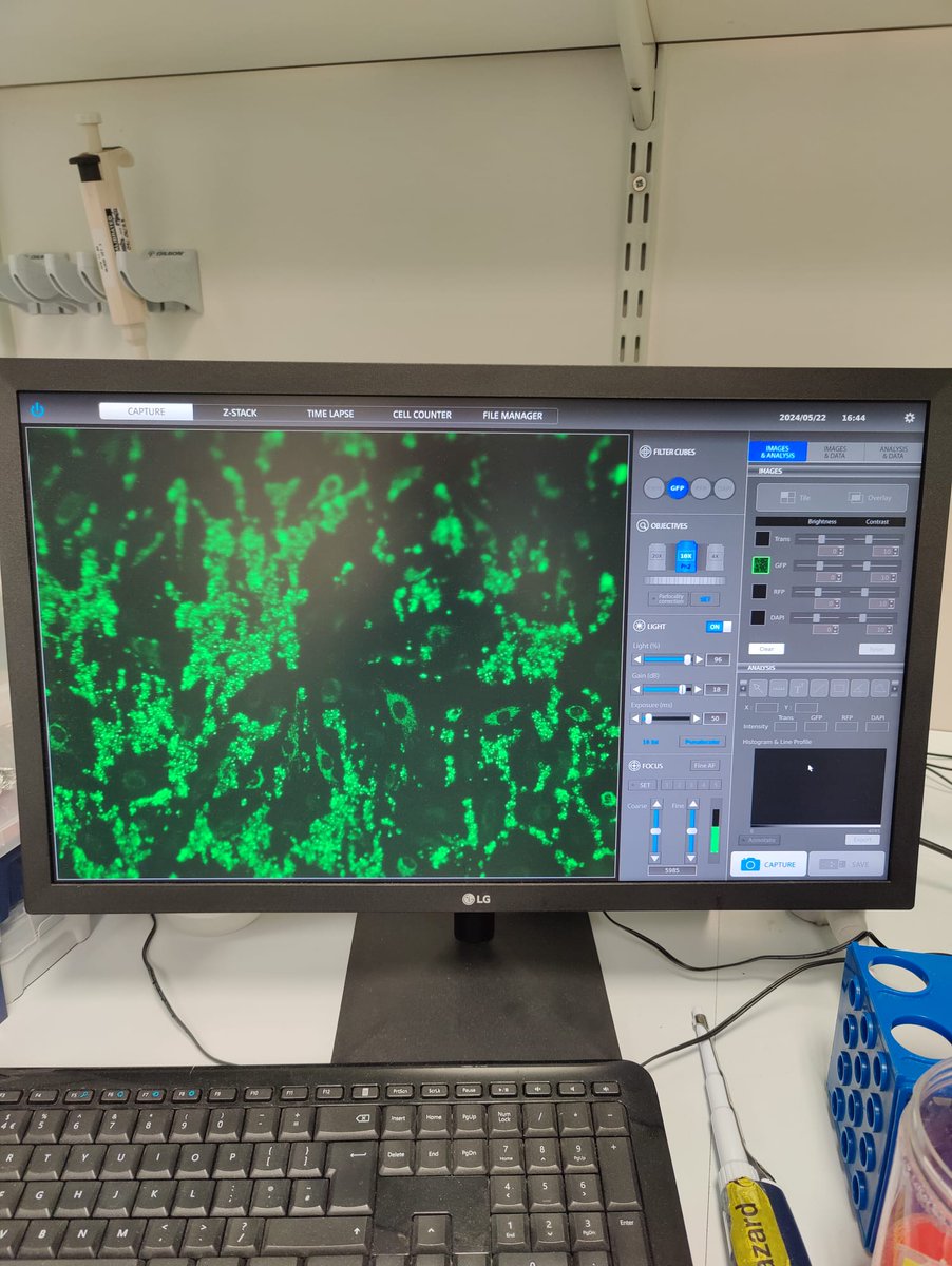 MMU Thrombosis Research Group (@mmu_thrombosis) on Twitter photo #ThrombosisThursdays!
@BHF funded PhD students <a href="/EimaKarim6/">Eima Karim</a> and <a href="/marblanez/">María Blanco López</a> have been busy in the lab learning and running our in vitro #thrombosis models!
#teamwork
<a href="/MMU_LifeScience/">ManMet Life Sciences</a> <a href="/mmucvrg/">MMU Cardiovascular Research Group</a> #ThrombosisThursdays!
@BHF funded PhD students <a href="/EimaKarim6/">Eima Karim</a> and <a href="/marblanez/">María Blanco López</a> have been busy in the lab learning and running our in vitro #thrombosis models!
#teamwork
<a href="/MMU_LifeScience/">ManMet Life Sciences</a> <a href="/mmucvrg/">MMU Cardiovascular Research Group</a>