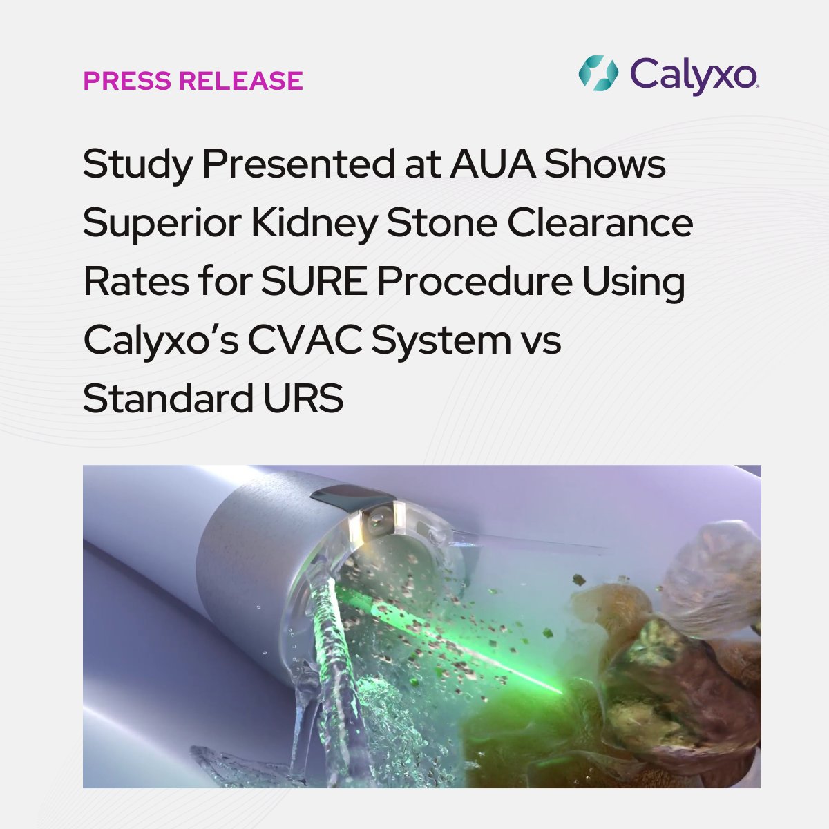 📢 Study data presented at #AUA24 shows that Calyxo's SURE procedure with the CVAC System outperformed standard ureteroscopy in a number of areas, including higher stone clearance rates and dramatically lower emergency department visits after one year of follow-up.

Read more