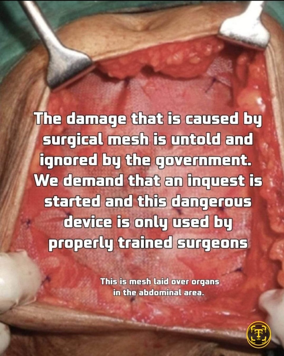 The abdominal mesh that I have been implanted with was put directly over my bowel which was an error. This caused my body to form adhesions sticking my organs together. I have sheets of mesh inside me, not only a small plug that most men get without problems. Mine is polyester.