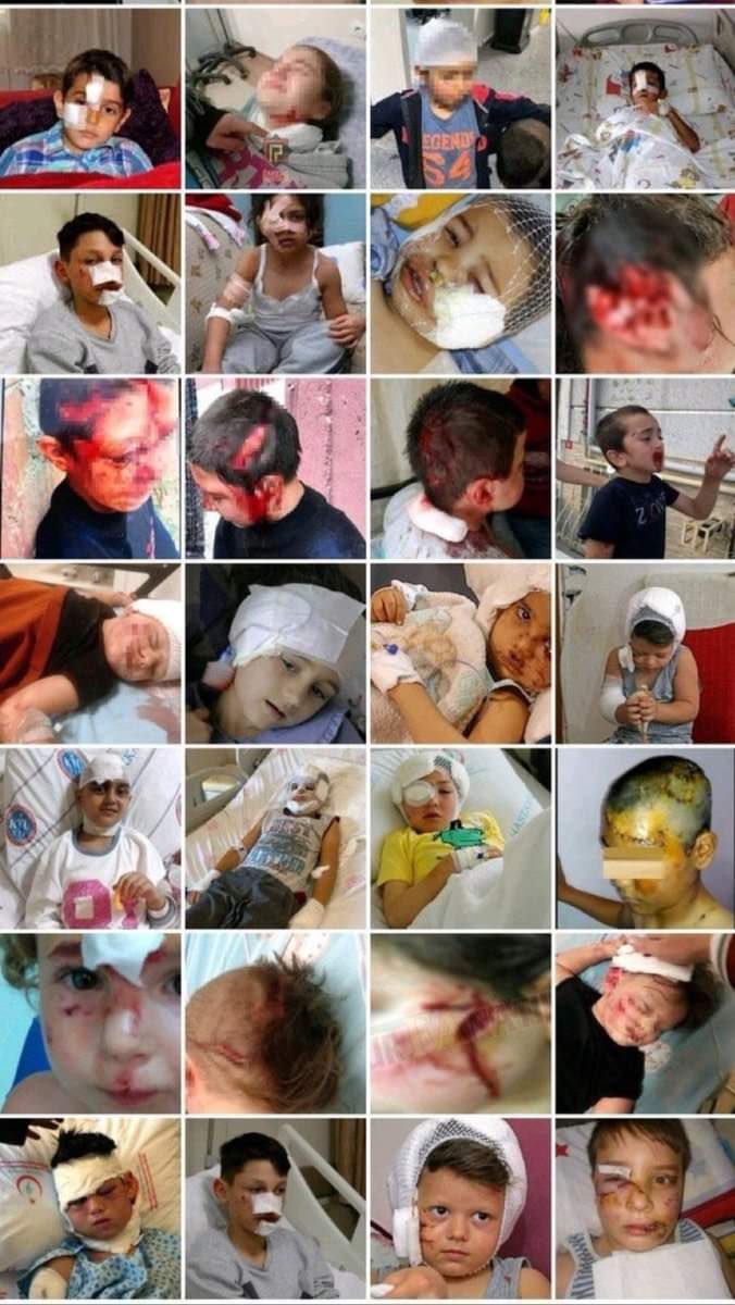 av_ahmetgul's tweet image. Her gün binlerce vatandaşımız #başıboşköpekler tarafından ısırılmakta,sebep oldukları kazalarda ve saldırılarda onlarca vatandaşlarımız parçalanarak ölmektedir.Mikrop ve terör yuvası haline gelen köpek çeteleri ile oluşturdukları ilkel görüntülerin ortadan kaldırılması zaruridir