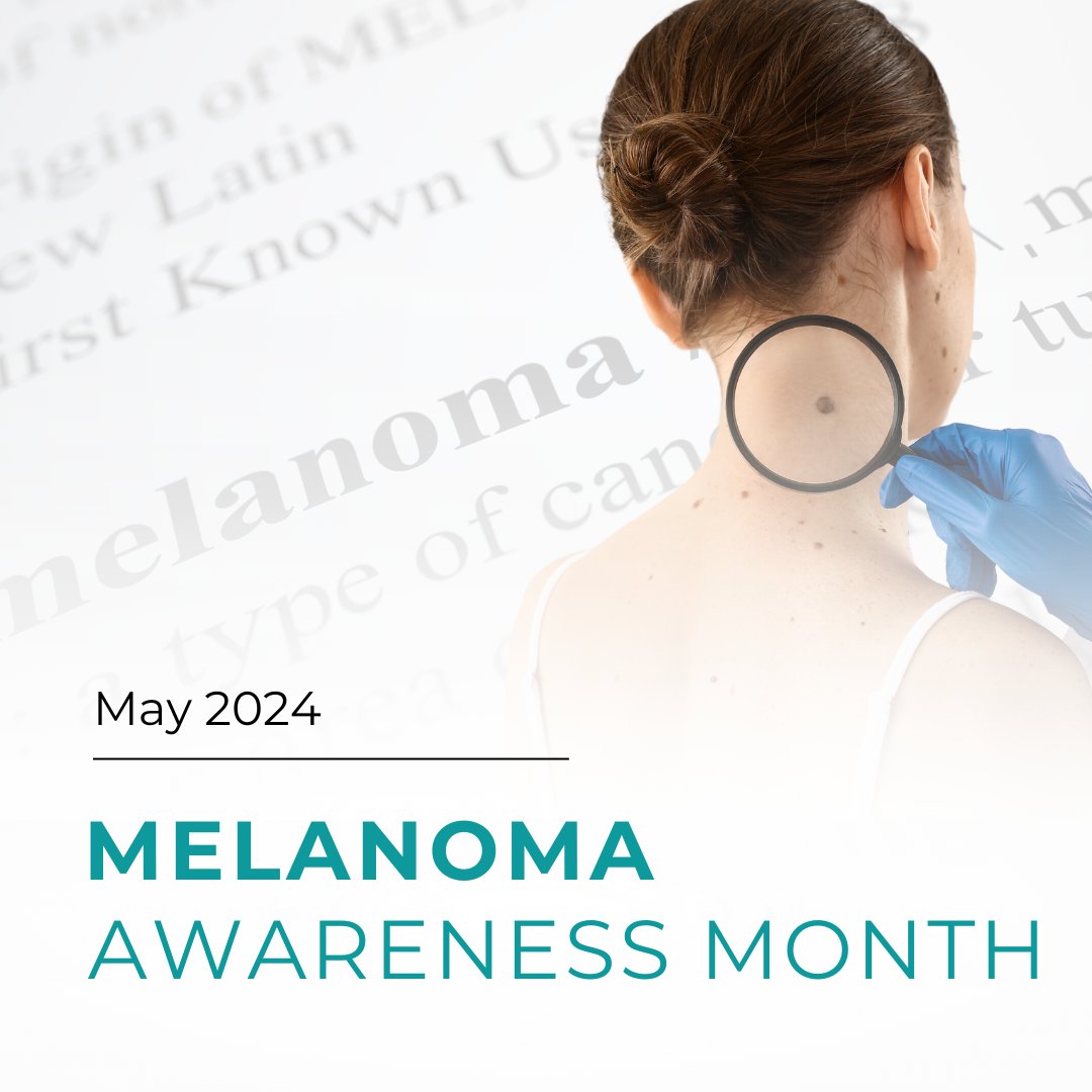 Melanoma is the most severe type of skin cancer, forming in melanocytes, the cells that produce melanin, which gives our skin its color. Known as malignant melanoma, it accounts for 75% of all skin cancer deaths.

‼️ Early detection is crucial for effective treatment ‼️