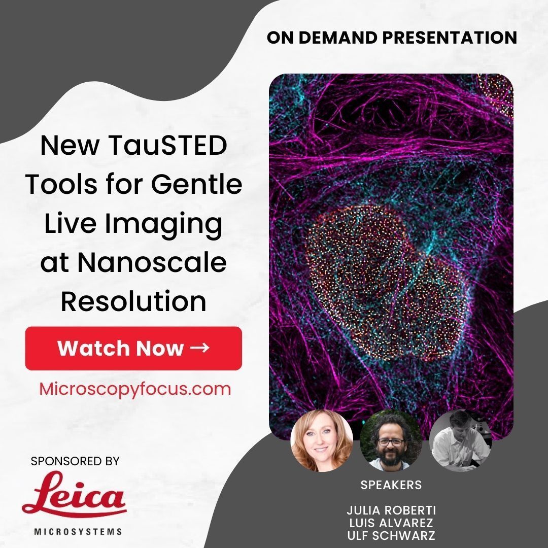 BitesizeBio's tweet photo. Showcasing the latest #STED #microscopy tools from @LeicaMicro. Capture the dynamics of subcellular species in live specimens at nanoscale resolution. #LiveCellImaging #MultiplexImaging #Nanoscopy Watch now → https://t.co/vKz5OTX7v6 https://t.co/cvPE007w3E