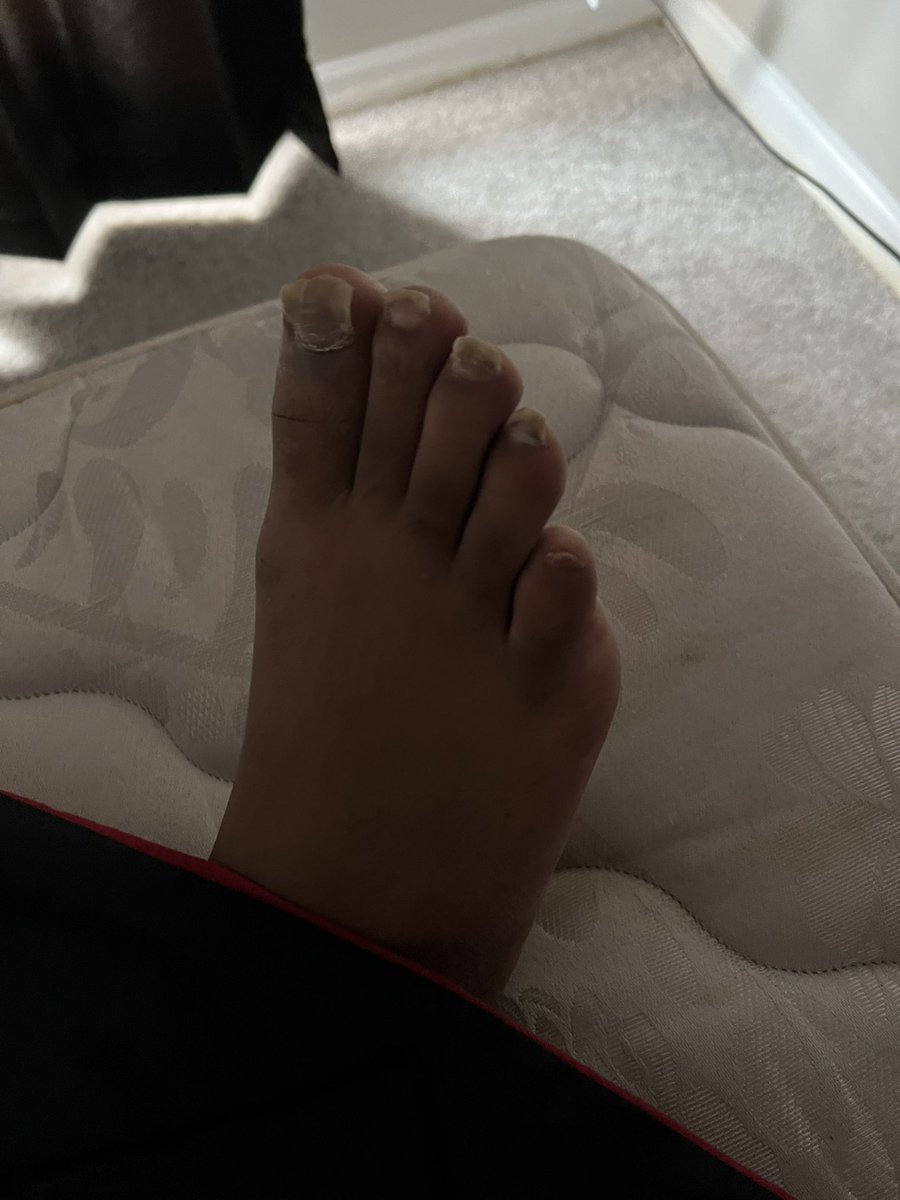 Mixed_Chick3's tweet photo. @Mike_St724 pedicure please🤣😩 https://t.co/dLL3hZ1VJG