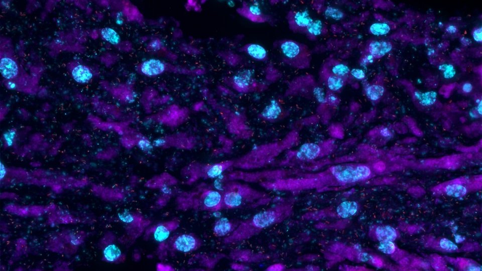 Australian Institute of Marine Science (@aims_gov_au) on Twitter photo The cosmos inside a sea sponge 🌠
<a href="/DrHMLuter/">Heidi Luter</a> + @Bettinaglasl are studying the interaction between #microbes & sponges to confirm the microbe’s role in nutrient cycling, particularly in the removal & conversion of ammonia, which can become toxic to their host.
@DOME_Vienna The cosmos inside a sea sponge 🌠
<a href="/DrHMLuter/">Heidi Luter</a> + @Bettinaglasl are studying the interaction between #microbes & sponges to confirm the microbe’s role in nutrient cycling, particularly in the removal & conversion of ammonia, which can become toxic to their host.
@DOME_Vienna