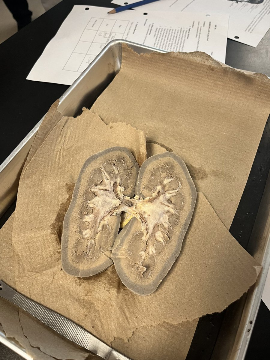 Kidney lab today in 4U Bio <a href="/StFXOCSB/">St. Francis Xavier High School</a>