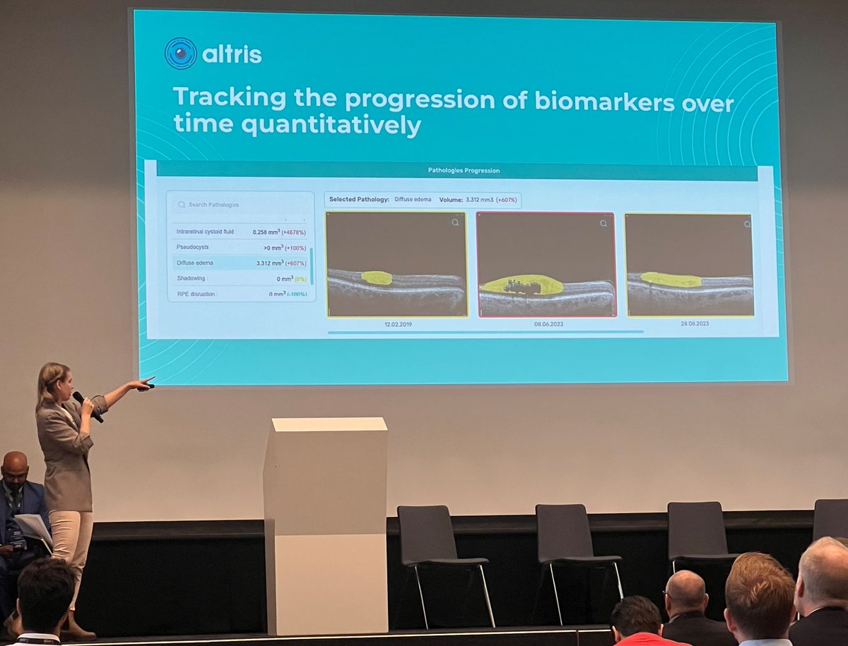 Altris - FDA, CE certified AI-powered OCT analysis tweet media