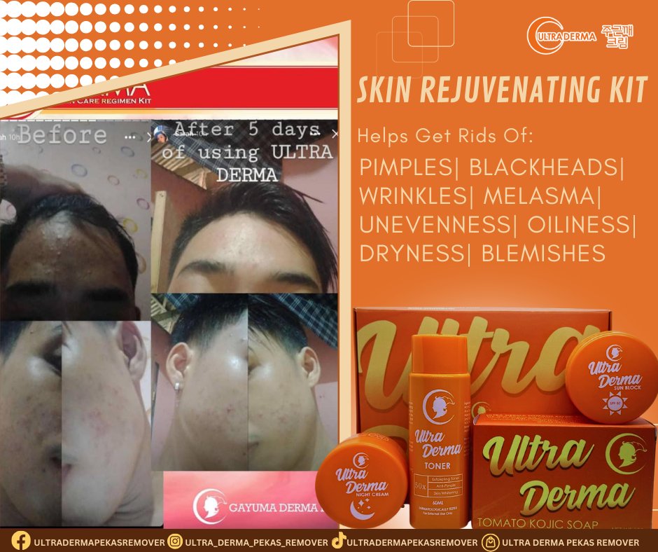 🧡🧡Ultra Derma🧡🧡
🧡🧡Skin Rejuvenating Kit 🧡🧡
#ultradermapekastoner
#ultradermatrio
#ultradermaduo
#ultradermatomatokojicsoap
#ultradermapekascreamremover
#ultradermapekascream
#FDAapprovedProduct
#dermatologisttested