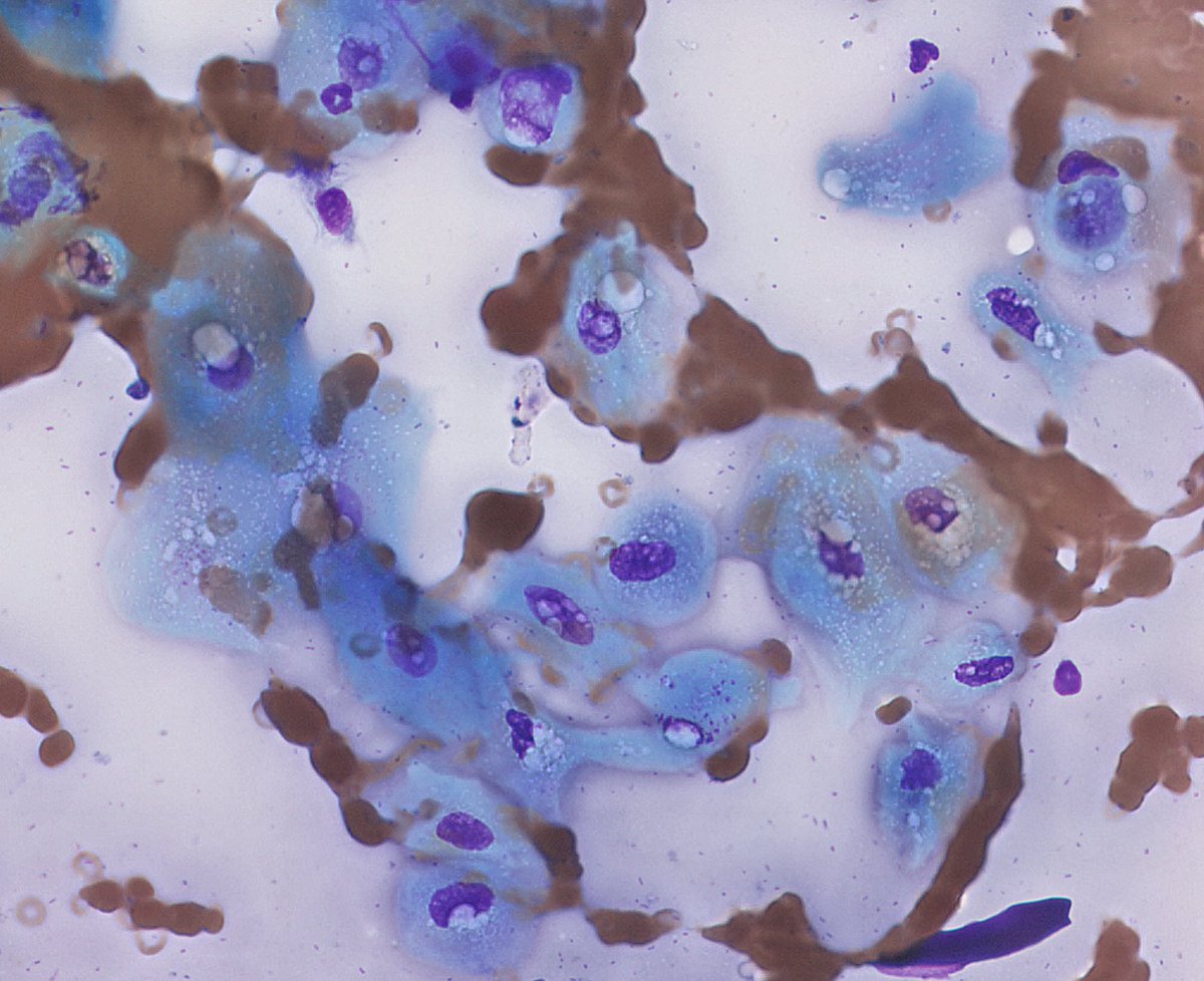 Art of veterinary cytology... 
Squamous epithelial cells (keratinoid/ mild cellular atypia)