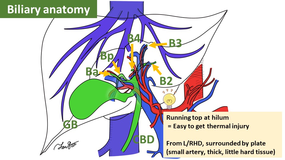 To imagine surgical view, I recommend to divide anatomy to each component. Set up the operative position!