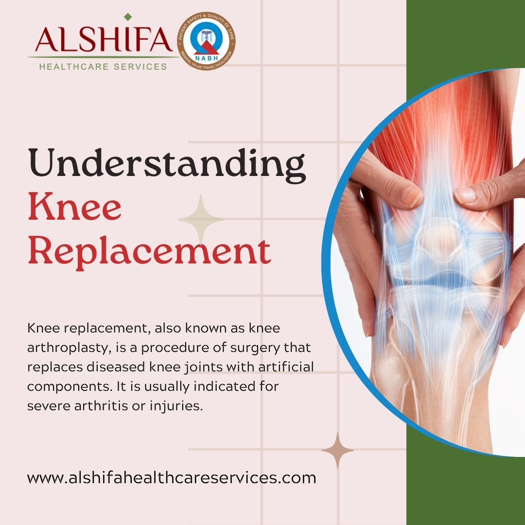 Alshifaglobal's tweet photo. #kneereplacementsurgery in India is a common and inexpensive treatment performed by skilled surgeons in advanced medical facilities, providing a cost-effective choice with success rates for #internationalpatients. https://t.co/mG2zvkznPD