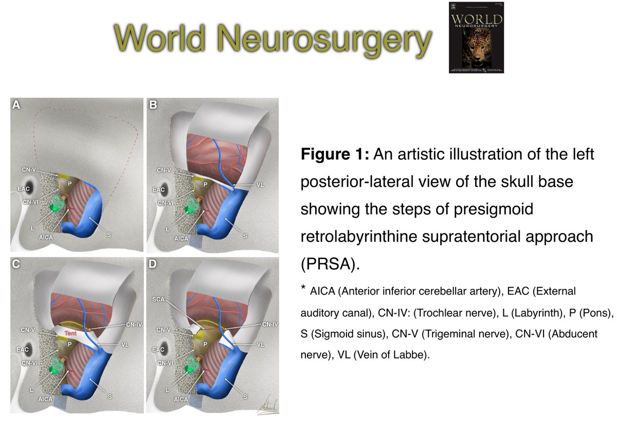 One of my favorite illustrations is in World Neurosrgery Journal <a href="/WorldNeurosurg/">World Neurosurgery Journal</a>