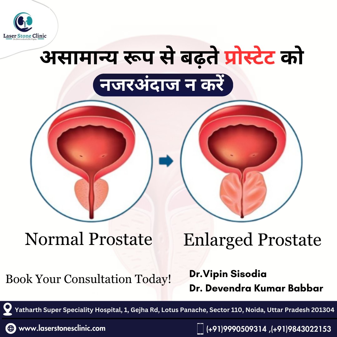 LaserStones's tweet photo. असामान्य रूप से बढ़ते प्रोस्टेट को नजरअंदाज न करें
📌 Normal Prostate
📌 Enlarged Prostate
-
☎️Contact us:-(+91)9990509314,(+91)9843022153.
**
#DrVipinSisodia #DrDevendraKumarBabbar #kidneystone #normalprostate #englargedprostate #kidney #besturologist #laserstonesclinic https://t.co/a5XB26uTk3