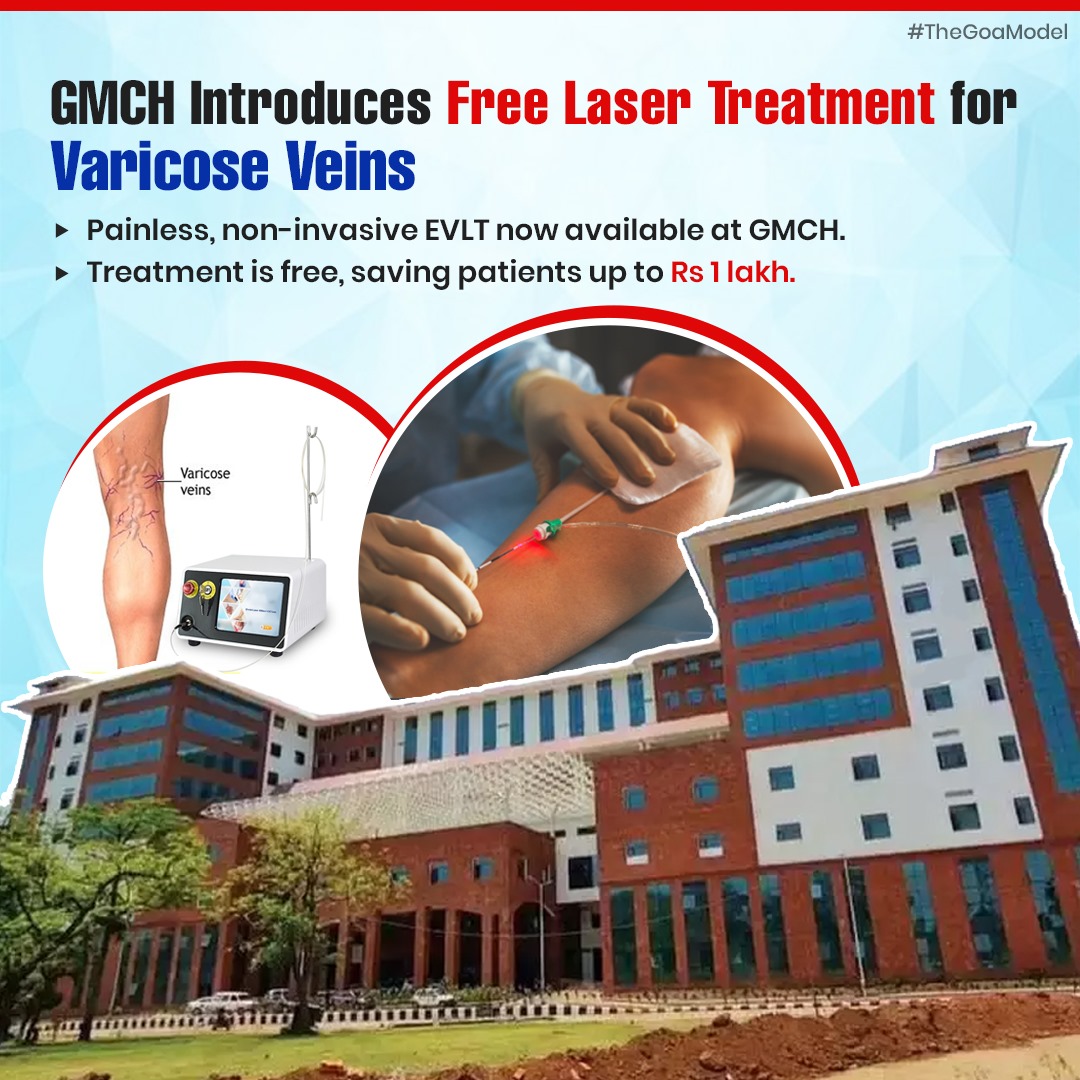 Great news for those suffering from varicose veins! GMCH introduces free Endovenous Laser Technology (EVLT) treatment. Painless and non-invasive, patients can walk out in just two hours! #TheGoaModel
#VaricoseVeinsTreatment #EndovenousLaserTechnology #PainlessTreatment