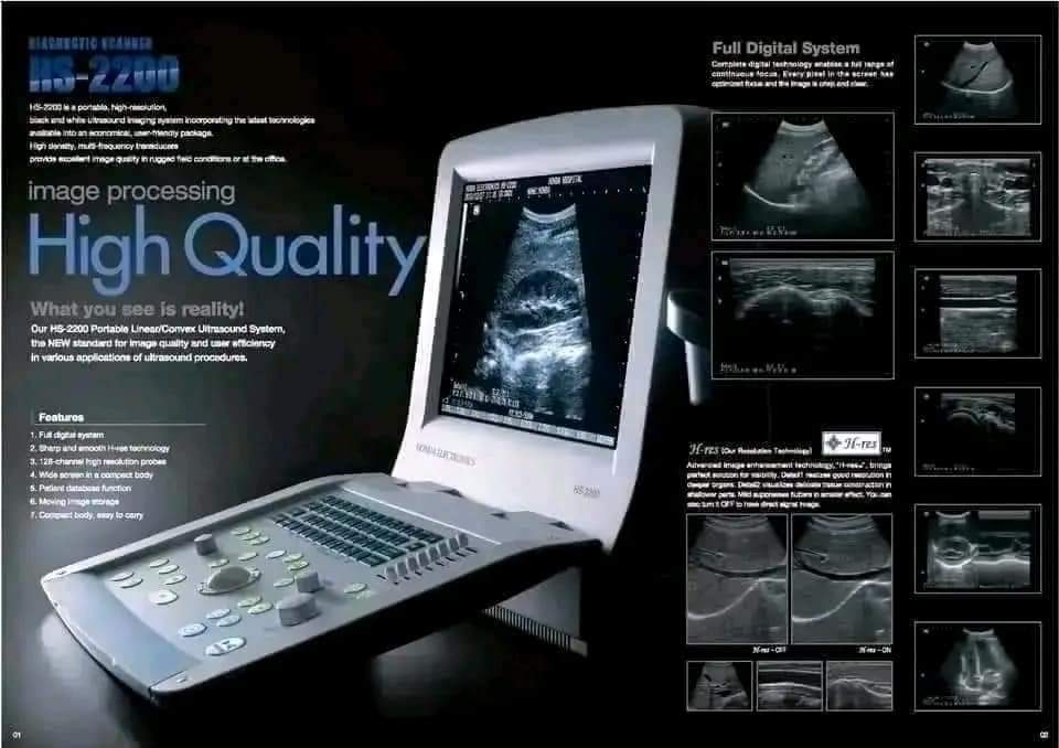 BiotechService3's tweet photo. HONDA JAPAN 🇯🇵 ULTRASOUND  
HS-2200
Resolution is Everything !!!  Buy Once &amp; Forever.
Contact 03018601954+WhatsApp
#honda 
#biotech 
#GYNAECOLOGIST 
#Sonologist 
#urologist 
#japanese #forever 
#Top10 #medicalequipmentsupplier #ultrasoundmachine #medicalequipment #gynaecology https://t.co/E6jzZVwyrw