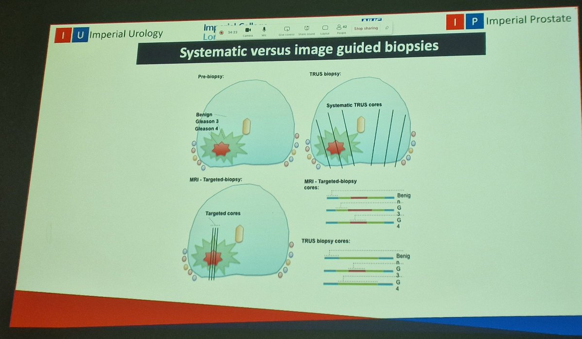 LambAlastair's tweet photo. @LondonProstate1 delivers @NDSurgicalSci #SGR with majestic overview of a decade of disruptive research in #ProstateCancer diagnostics &amp; decision-making. 
-challenges of equipoise
-pressures to amend policy before level 1 evidence available 
-need for comparative data
@IP_London https://t.co/TbTOx7J1xz