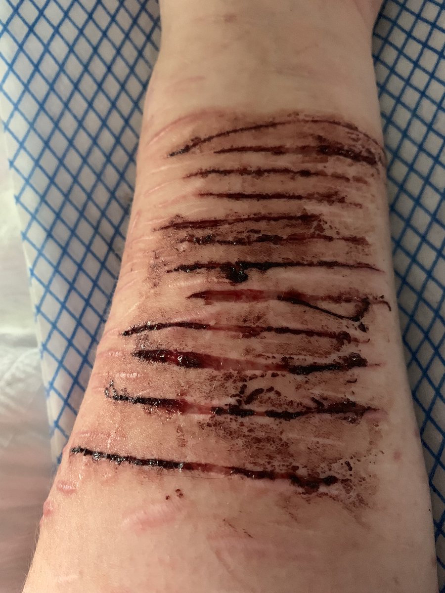 st4r_te's tweet photo. Little relapse 

Sfx. https://t.co/XvyyHgGvkJ