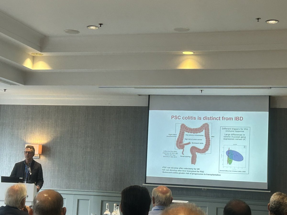 Kicking off an amazing programme to celebrate the outstanding career of Prof Darius Mirza. Prof David Adams opening the session talking about the gut liver axis in PSC @Bham_HPB_LTx @BirminghamBRC @uhbtrust @NabilQuraishi @jfergus75 @aelsharkawy75 @Drfattyliver @NeilRajJ1