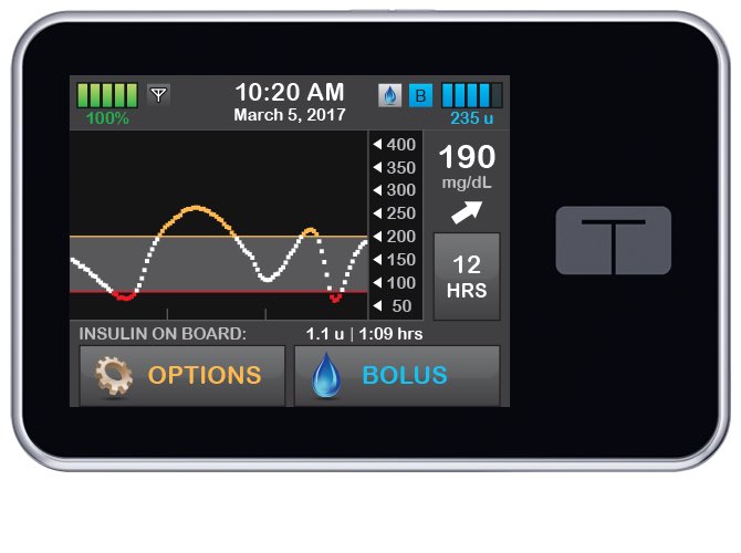 MarcLungley's tweet image. Off to #TAD24 tonight and today is the two-year anniversary of going on an insulin pump. Since I've had me #TSlimX2 I haven’t looked back. Insulin Pump therapy is good but I can’t wait till those of us that are ‘too good’ can get on #HCL. 

#DiabetesChat #GBDoc #dedocvoices