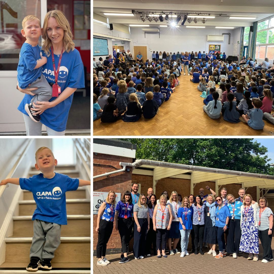 Danielle turned her workplace and her son’s primary school blue during Cleft Lip and Palate Awareness Week, raising over £1,500 for CLAPA. She told us, “We have personally benefited from CLAPA's knowledge, support, and expertise from the moment we received our diagnosis.'
