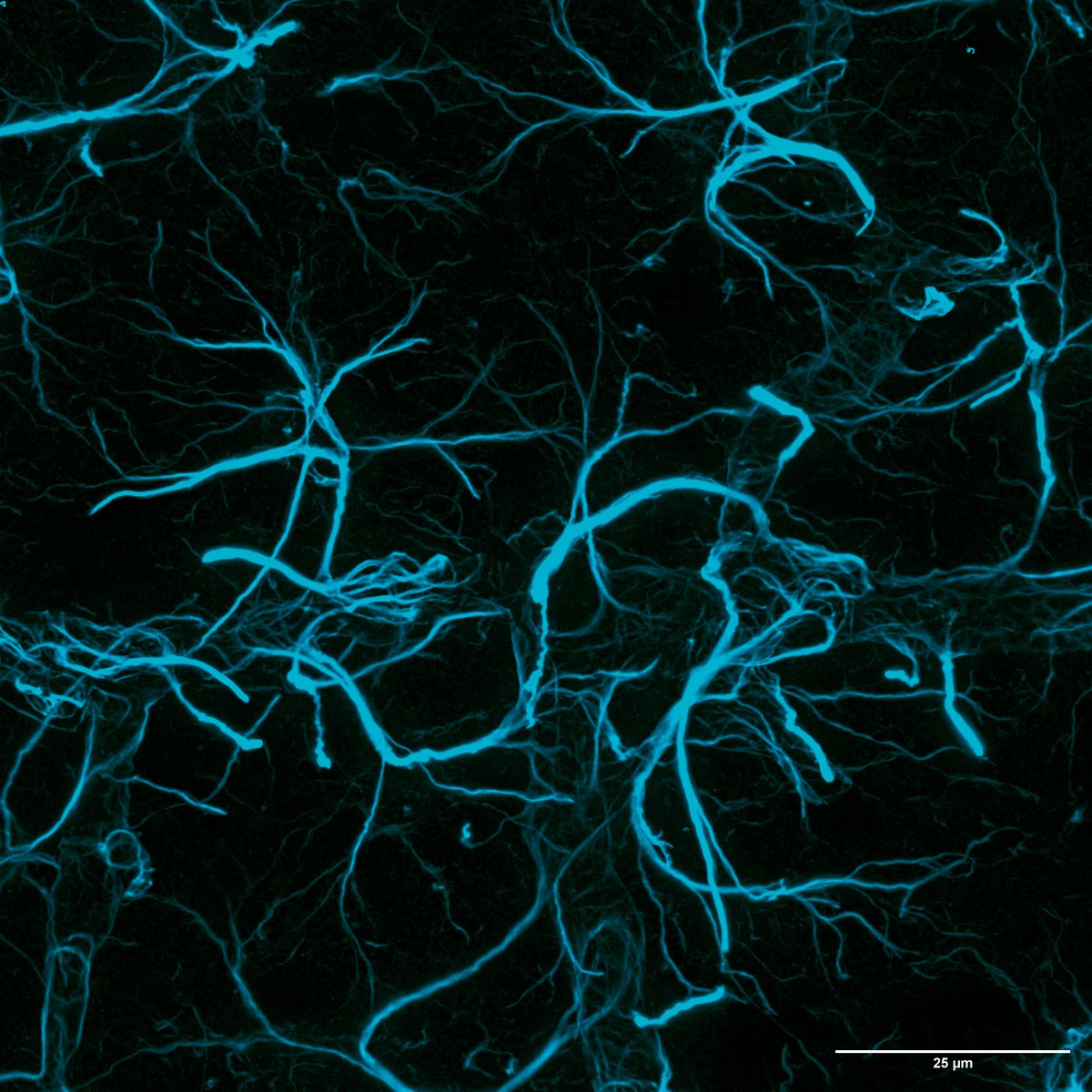 Playing around with 3D STED.

A tangled junction, Astrocytes (GFAP) wrapping around the branching cerebral vasculature (negative space).

#FluorescenceFriday #Neuroscience #Astrocytes #Microscopy #Leica #STED @RCSI_Irl