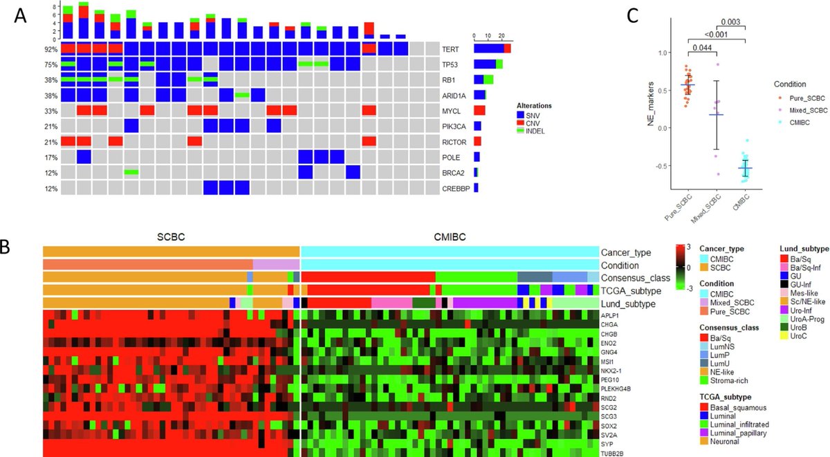 Identification of Lineage-specific Transcriptional Factor–defined Molecular Subtypes in Small Cell Bladder Cancer by Mingxiao Feng et al Read full article here: europeanurology.com/article/S0302-… @Andres_Matoso @urogabe @evacomperat @MaxKates @djmcconkey #UroSoMe #Medtwitter