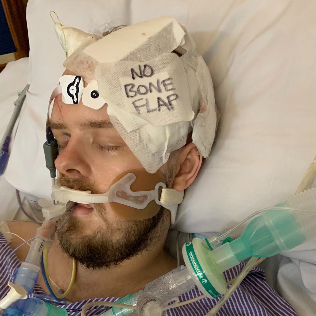 Irwin Mitchell Personal Injury & Med Neg (@piandmedneg) on Twitter photo Mads Vallestad suffered a traumatic brain injury in a hit and run. After our experts secured him access to rehabilitation, Mads is supporting <a href="/HeadwayUK/">Headway - the brain injury association</a>’s #ABIWeek. Mads says he's determined to overcome his injuries and help others in a similar situation. irwinmitchell.com/news-and-insig… Mads Vallestad suffered a traumatic brain injury in a hit and run. After our experts secured him access to rehabilitation, Mads is supporting <a href="/HeadwayUK/">Headway - the brain injury association</a>’s #ABIWeek. Mads says he's determined to overcome his injuries and help others in a similar situation. irwinmitchell.com/news-and-insig…