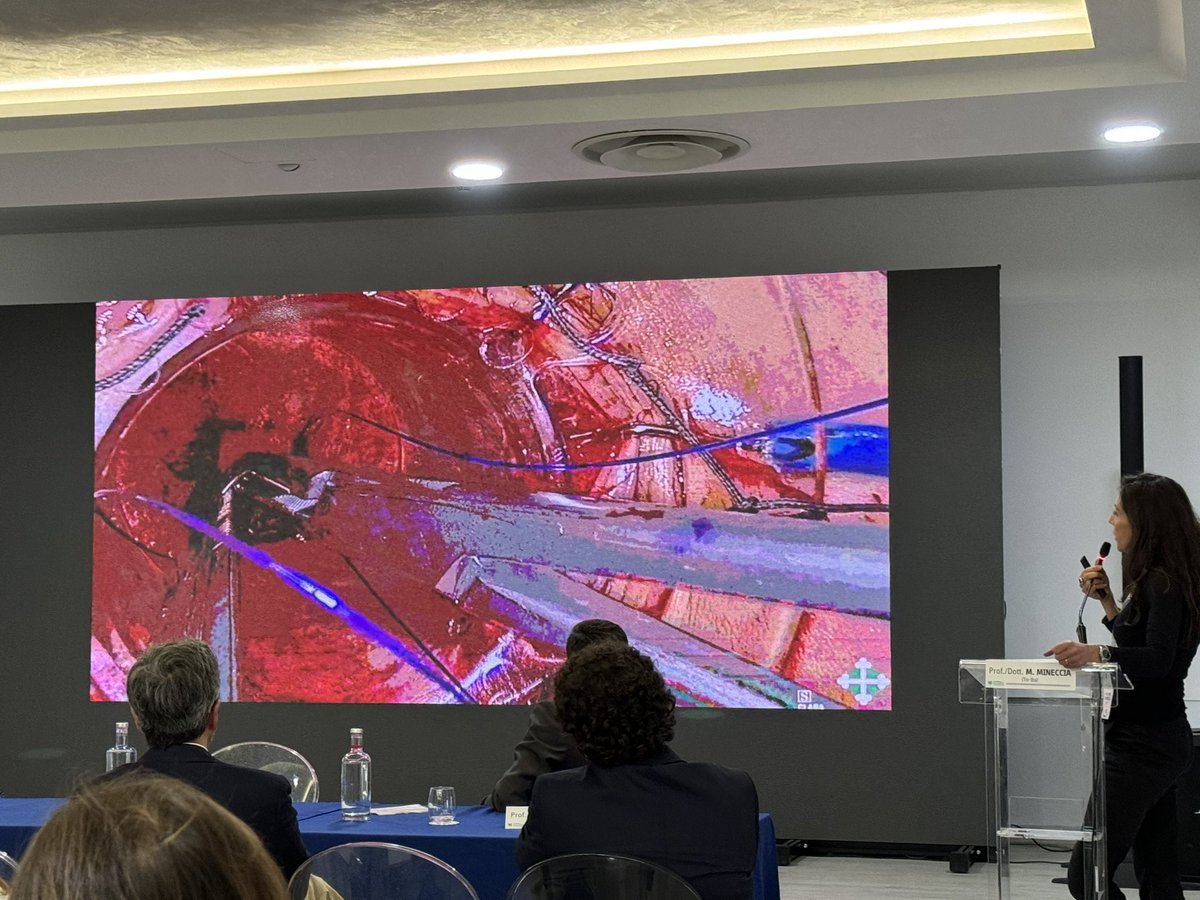 Nicolas Avellaneda (@nlavellaneda) on Twitter photo #TTSS spreading all around the world - Will this be the new gold standard for low rectal Cancer/IPAA?
Possible? PROBABLE.
<a href="/AntoninoSpin/">Antonino Spinelli</a> <a href="/caterina_foppa/">Caterina Foppa</a> <a href="/mic_carvello/">Michele Carvello</a> <a href="/pakotze/">Paulo G. Kotze</a> <a href="/VVigorita/">Vincenzo Vigorita MD, PhD, EBSQ-c, FACS</a> <a href="/MiguelCunhaSurg/">Miguel F. Cunha</a> <a href="/HumanitasCRS/">Humanitas Colorectal Surgery</a> #TTSS spreading all around the world - Will this be the new gold standard for low rectal Cancer/IPAA?
Possible? PROBABLE.
<a href="/AntoninoSpin/">Antonino Spinelli</a> <a href="/caterina_foppa/">Caterina Foppa</a> <a href="/mic_carvello/">Michele Carvello</a> <a href="/pakotze/">Paulo G. Kotze</a> <a href="/VVigorita/">Vincenzo Vigorita MD, PhD, EBSQ-c, FACS</a> <a href="/MiguelCunhaSurg/">Miguel F. Cunha</a> <a href="/HumanitasCRS/">Humanitas Colorectal Surgery</a>