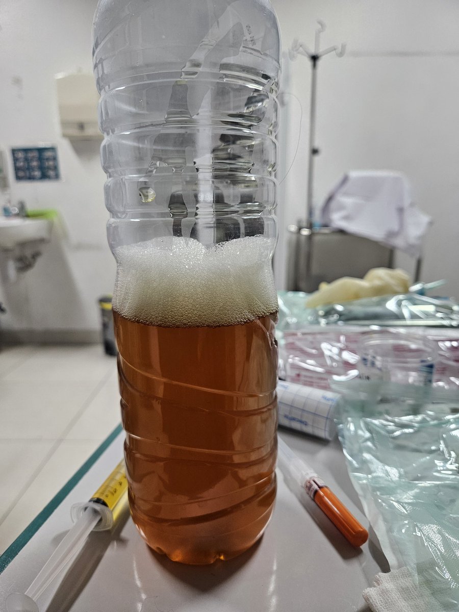 Buat saudara saudari yg ingin menurunkan berat badan, hati-hati dalam memilih cara diet.
Sebaiknya konsul ke dokter ahlinya.

Demi kesehatan, jangan pakai ilmu dari google apalagi ilmu yg bersumber "katanya"

Karena kami sering mendapati pasien yg menderita TBC pasca menjalankan