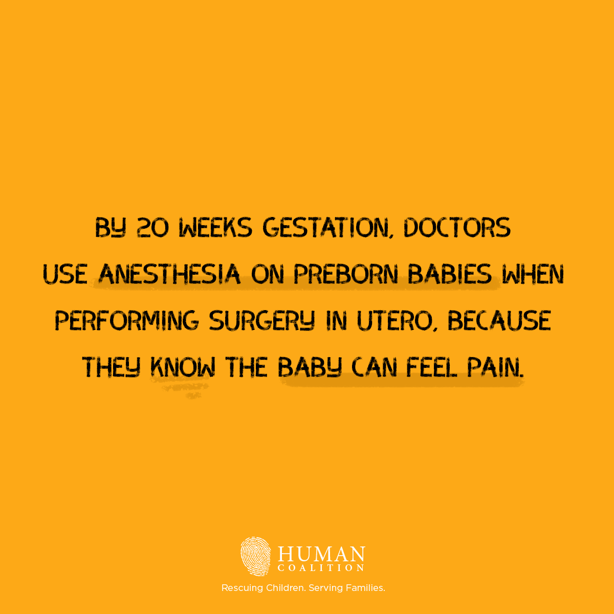 redusa21's tweet photo. Unborn babies feel pain. https://t.co/RJTXk1vcsG