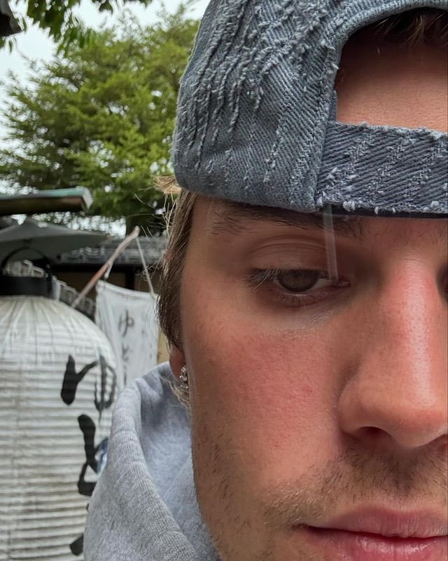 getdrew's tweet image. a pele perfeita