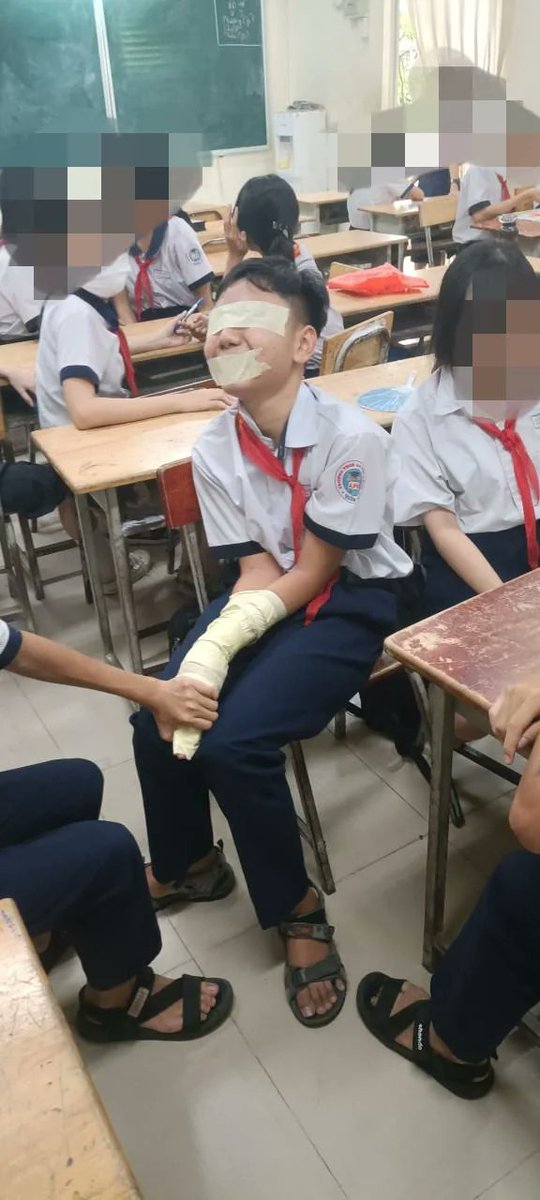 Chói e học sinh ☺️