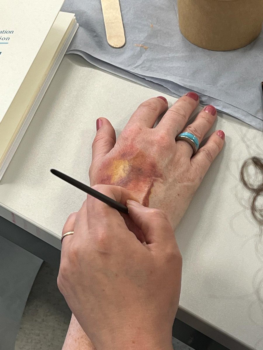ASSERT Centre, UCC. (@uccassert) on Twitter photo <a href="/UCCASSERT/">ASSERT Centre, UCC.</a> Director, Leonie Heskin and Mike Cronin deliver a Moulage workshop at <a href="/IrishSimAssoc/">IrishSimulationAssoc</a> symposium 2024. Moulage adds another layer of complexity to thesimulation based learning experience. deepening the story behind the scenario and makes the mankin more life like. <a href="/UCCASSERT/">ASSERT Centre, UCC.</a> Director, Leonie Heskin and Mike Cronin deliver a Moulage workshop at <a href="/IrishSimAssoc/">IrishSimulationAssoc</a> symposium 2024. Moulage adds another layer of complexity to thesimulation based learning experience. deepening the story behind the scenario and makes the mankin more life like.