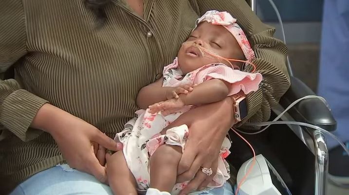 Premature Baby Girl Born at 22 Weeks Heads Home From Hospital buff.ly/3UTVtkl