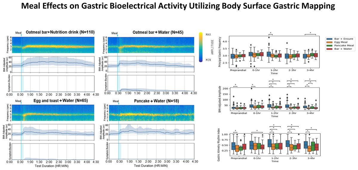 🆕🔥Meal effects on #gastric #BioelectricalActivity utilizing #BSGM in healthy subjects‼️ ✅#Lower-calorie meals are associated with ⬇️ #PostprandialAmplitude & #RhythmStability when compared to standard Gastric #AlimetryMeal👏 👉onlinelibrary.wiley.com/doi/10.1111/nm… @ANMSociety @esnm_eu