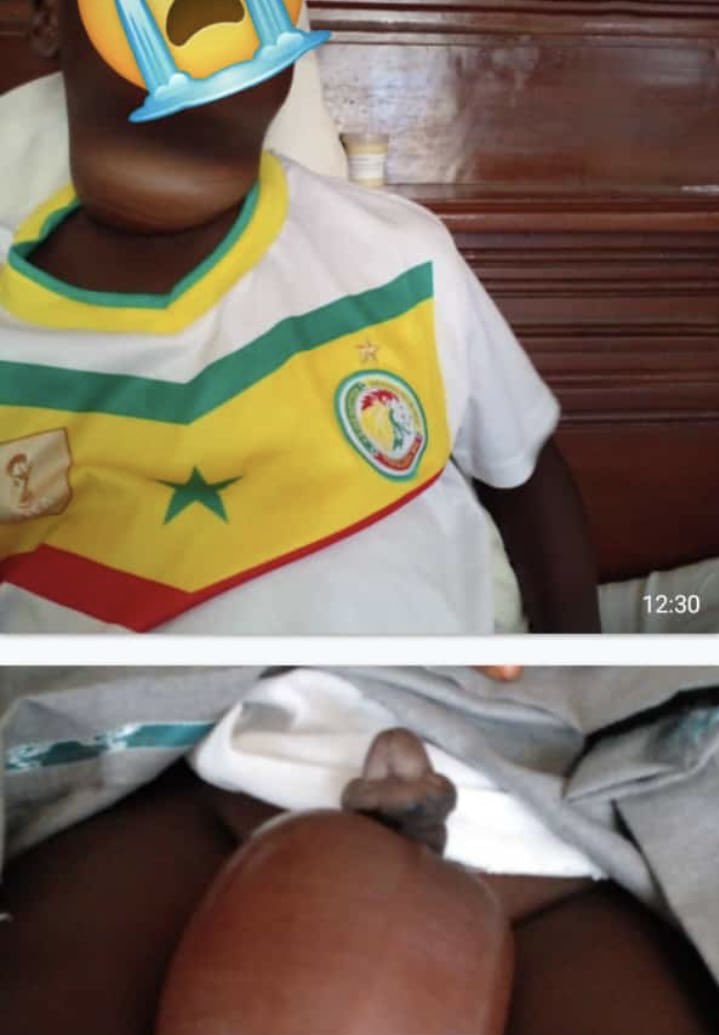 Makhfouss2's tweet image. 🚨URGENCE 🚨

Salam la famille, 
Nous attirons votre attention sur cette enfant. Il souffre énormément, il doit faire une operation en URGENCE et ces parents n’ont pas les moyens pour le soigner. Nous comptons sur vos dons pour le soigner.  

🚨Wave / Orange Money : 77 795 27 42