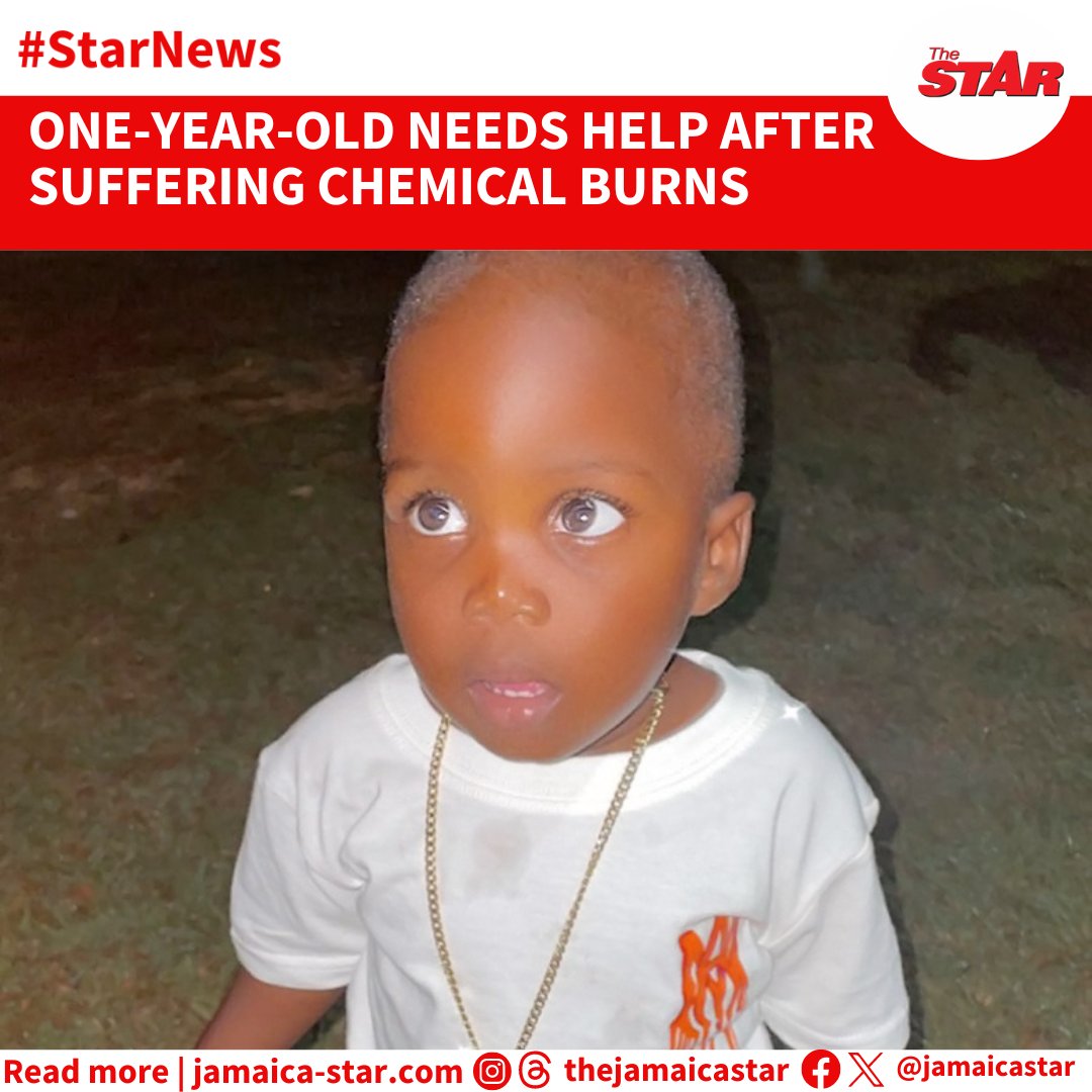 #StarNews: The mother of one-year-old Jamar Thomas, who was severely burnt by chemicals in an accident, is seeking assistance to raise funds for surgery so that he can have a normal life again. READ MORE: tinyurl.com/2mc3v9za