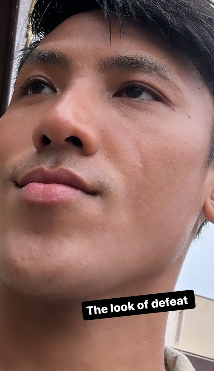 The look of defeat 📌