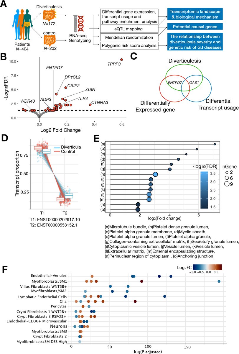 #GUTImage from the paper by Seo et al entitled

'Genetic and transcriptomic landscape of colonic diverticulosis' via bit.ly/4bK7kbq

#Diverticulosis